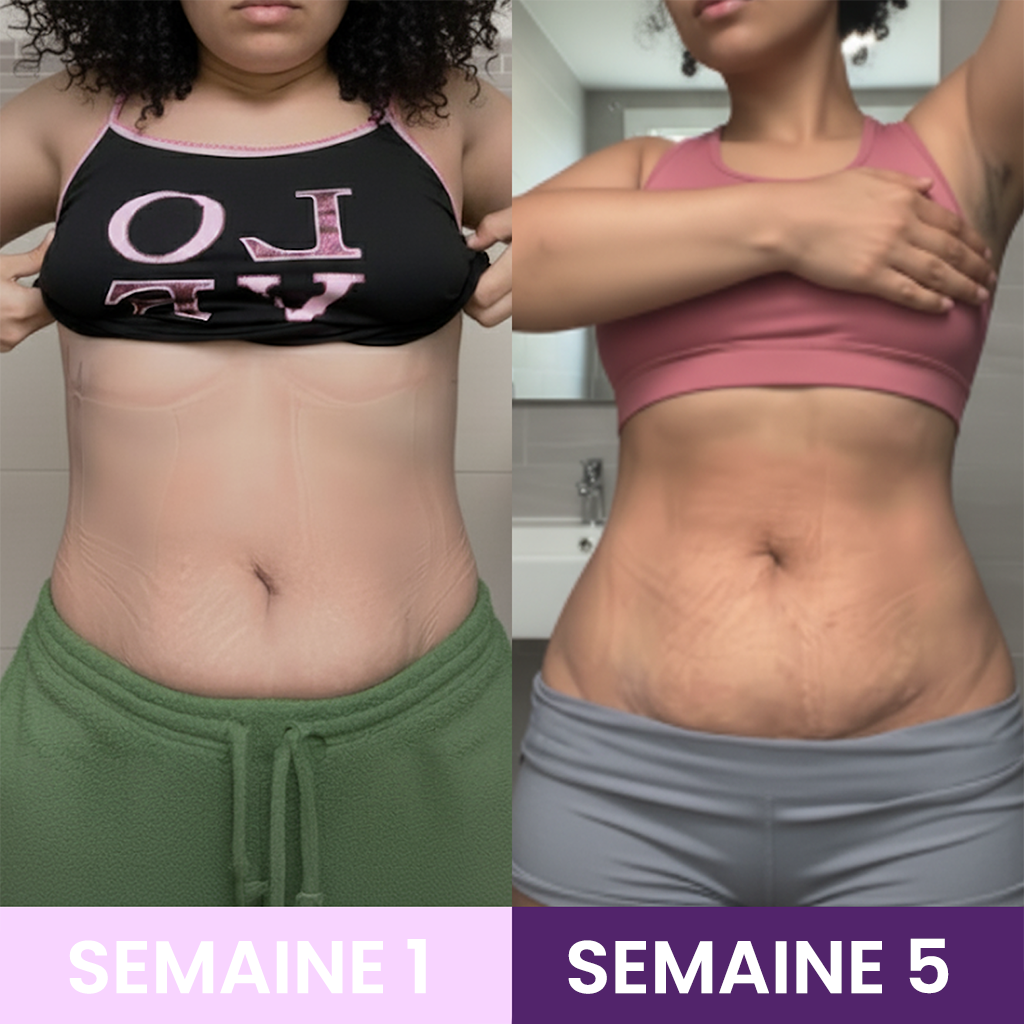 Seryova® 2.0 | Compresse la taille, sculpte la ligne, booste ta confiance.
